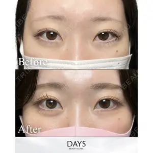 Days Beauty Clinic 新宿院の症例