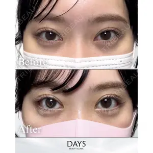 Days Beauty Clinic 新宿院の症例