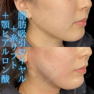 THE FIRST CLINIC 多摩センター院 惟村 公郁医師の症例