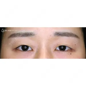 聖心美容クリニック 札幌院 前多 一彦医師の症例