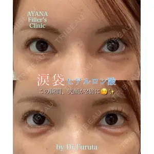 AYANAフィラーズクリニック 渋谷院 古田 晃医師の症例