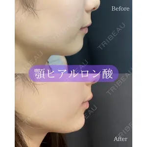 ルラ美容クリニック 郡山院 横瀬 晃平医師の症例