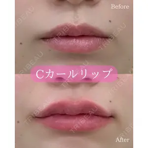 ルラ美容クリニック 郡山院 横瀬 晃平医師の症例