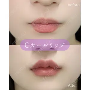 ルラ美容クリニック 郡山院 横瀬 晃平医師の症例