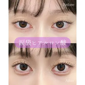 ルラ美容クリニック 郡山院 横瀬 晃平医師の症例