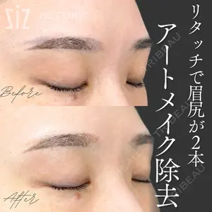 ziz CLINIC 村岡 史子医師の症例