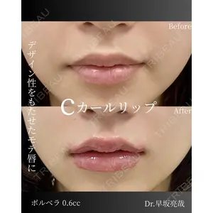 ルラ美容クリニック 札幌本院 早坂 亮哉医師の症例