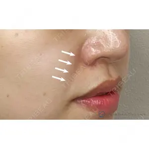 Original Beauty Clinic GINZA 佐藤玲史医師の症例