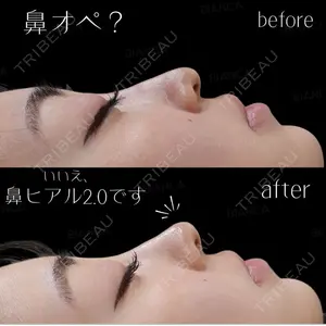 BIANCA銀座 池田 雪太郎医師の症例