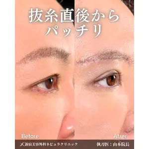 新宿美容外科ネビュラクリニック 山本 紘子医師の症例
