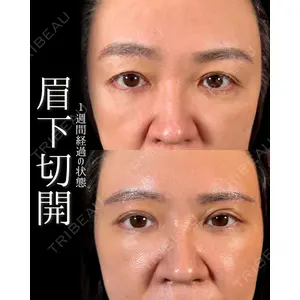 新宿美容外科ネビュラクリニック 山本 紘子医師の症例