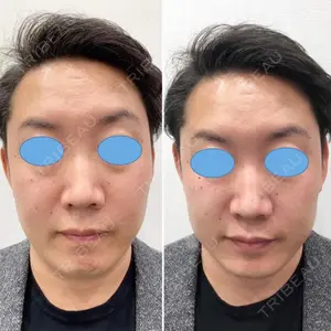 しのぶ皮膚科 蘇原しのぶ医師の症例