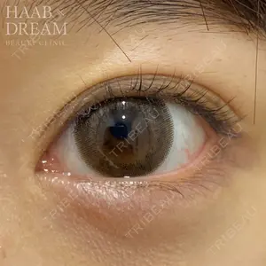 HAAB×DREAM BEAUTY CLINIC 東京本院 田中 優太医師の症例