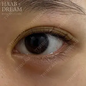 HAAB×DREAM BEAUTY CLINIC 東京本院 田中 優太医師の症例