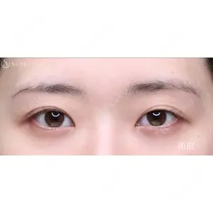 聖心美容クリニック 銀座院 川端 優也医師の症例