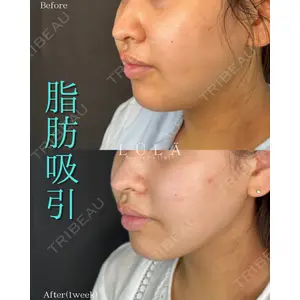 ルラ美容クリニック 町田院 松岡 舟作医師の症例