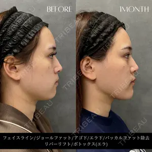RIVER CLINIC（リバークリニック）大阪院 木家 佑理子医師の症例