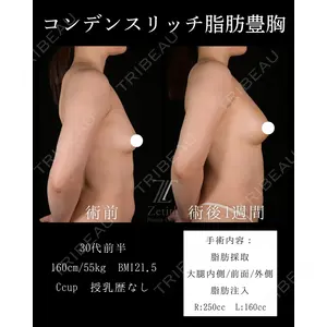 Zetith Beauty Clinic 大阪心斎橋院 山田真由香医師の症例