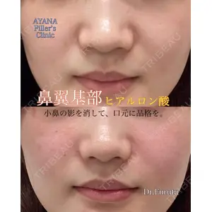 AYANAフィラーズクリニック 渋谷院 古田 晃医師の症例