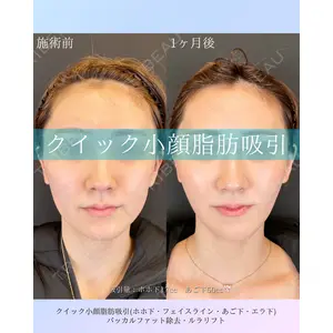 ルラ美容クリニック 札幌本院 佐藤 雄紀医師の症例