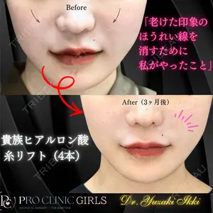 PRO CLINIC プロクリニック 銀座院 柚﨑 一輝医師の症例