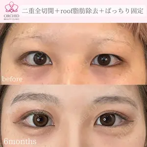 オーキッド美容クリニック東京御徒町 西浦 蘭子医師の症例