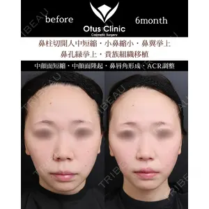 Otus Clinic 【オータスクリニック】 中 徳太郎医師の症例