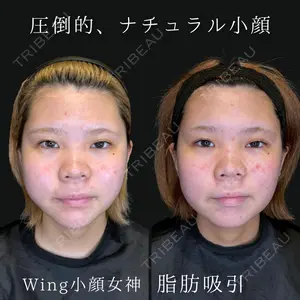 Wing clinic 豊中駅前院 速水 翼医師の症例