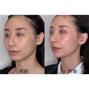GRACY TOKYO CLINIC【グレイシートウキョウクリニック】 江本 正樹医師の症例