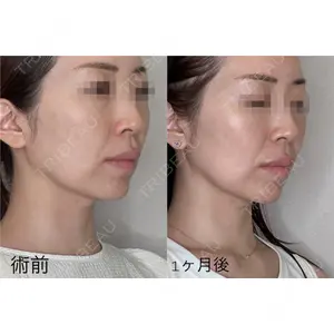 GRACY TOKYO CLINIC【グレイシートウキョウクリニック】 大西 真代医師の症例