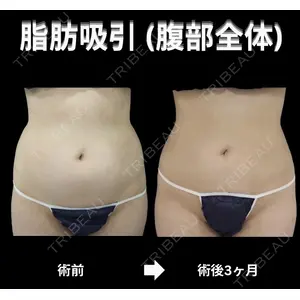 下北沢スキンクリニック 保坂 宗孝医師の症例