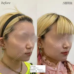 DMTC CLINIC 日本橋院 松井泉医師の症例