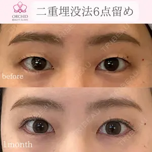 オーキッド美容クリニック東京御徒町 西浦 蘭子医師の症例
