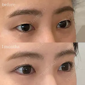 オーキッド美容クリニック東京御徒町 西浦 蘭子医師の症例