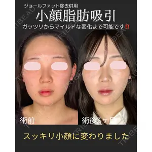 ルラ美容クリニック 仙台院 / ルラスキンクリニック 仙台院 橋本 英樹医師の症例