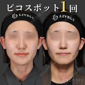 ライブリークリニック 浜松町院 林 政男医師の症例