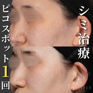 ライブリークリニック 浜松町院 林 政男医師の症例