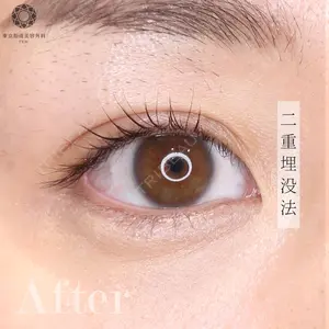 東京形成美容外科 銀座院 弓削田　浩主医師の症例