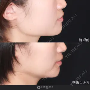 東京形成美容外科 船橋院 山崎 修吾医師の症例