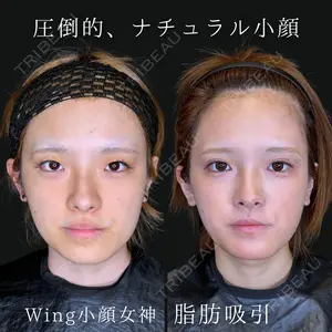 Wing clinic 豊中駅前院 速水 翼医師の症例