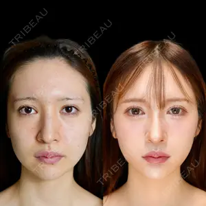 ルラ美容クリニック 池袋院 橋口 直哉医師の症例