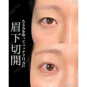 新宿美容外科ネビュラクリニック 山本 紘子医師の症例