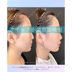 ルラ美容クリニック 札幌本院 佐藤 雄紀医師の症例