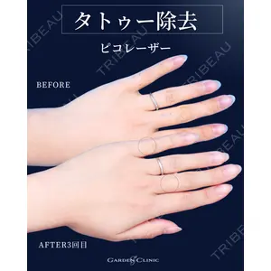 ガーデンクリニック 池袋院の症例