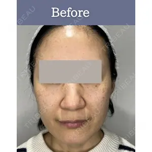 横浜山手クリニック 平山 桂子医師の症例