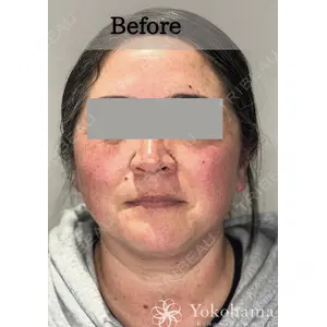 横浜山手クリニック 平山 桂子医師の症例