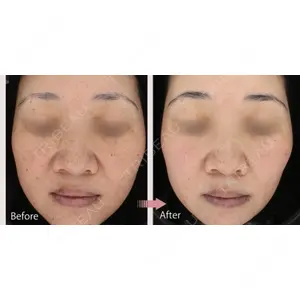 AZ BEAUTY CLINICの症例