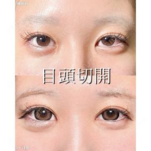 新宿美容外科ネビュラクリニック 山本 紘子医師の症例