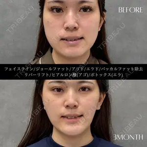 RIVER CLINIC（リバークリニック）大阪院 木家 佑理子医師の症例