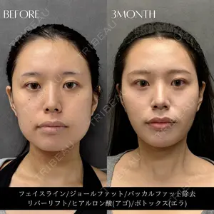 RIVER CLINIC（リバークリニック）大阪院の症例